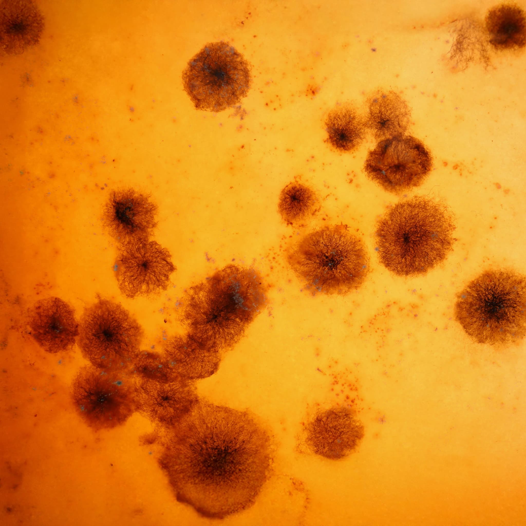 Astorg announces plans to combine Oxoid Remel Microbiology and Solabia's microbiology diagnostics division to create a leading global microbiology platform